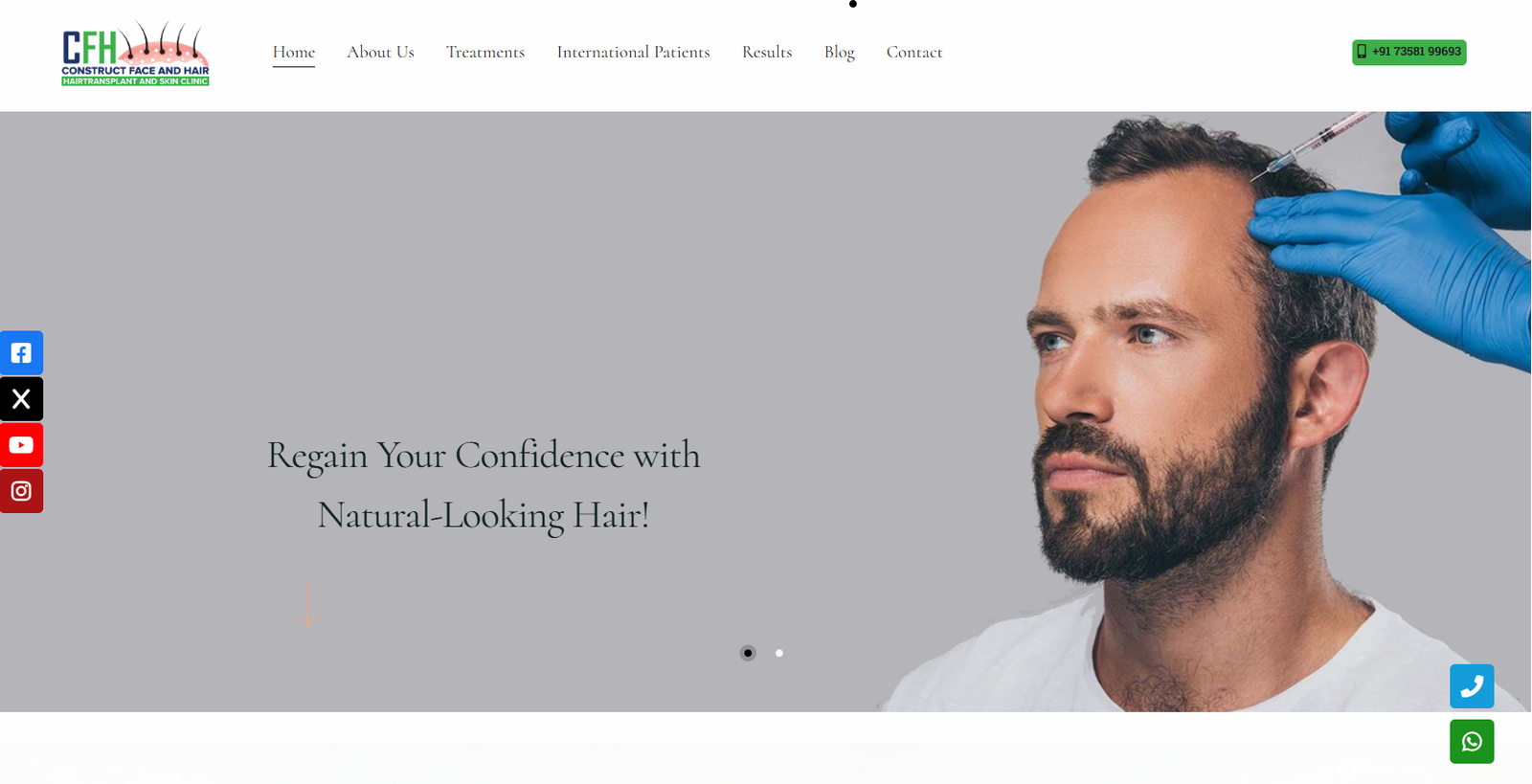 CFH Hair Transplant Website Design by MSLive Technologies